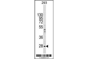 Western Blotting (WB) image for anti-Eukaryotic Translation Initiation Factor 2B, Subunit 1 Alpha, 26kDa (EIF2B1) (Center) antibody (ABIN2160844)