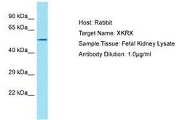 anti-XK, Kell Blood Group Complex Subunit-Related, X-Linked (XKRX) (AA 87-136) antibody