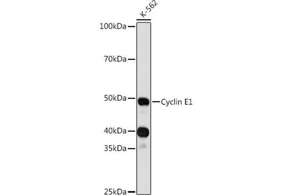 Cyclin E1 抗体