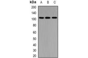 Image no. 1 for anti-Protein tyrosine Phosphatase, Non-Receptor Type 3 (PTPN3) (full length) antibody (ABIN6005356)