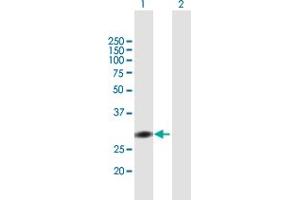 Image no. 1 for anti-Cell Cycle Checkpoint Protein RAD1 (RAD1) (AA 1-282) antibody (ABIN519540)