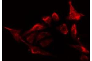 Image no. 3 for anti-Oxidative-Stress Responsive 1 (OXSR1) (pThr185) antibody (ABIN6256490)