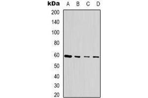 Image no. 2 for anti-tRNA Splicing Endonuclease 54 (TSEN54) antibody (ABIN2801330)