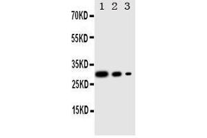Image no. 1 for anti-CREB Regulated Transcription Coactivator 1 (CRTC1) (AA 506-521), (C-Term) antibody (ABIN3042965)