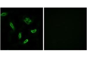 Image no. 3 for anti-Solute Carrier Family 27 (Fatty Acid Transporter), Member 5 (SLC27A5) (AA 481-530) antibody (ABIN1534695)