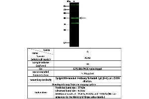 Image no. 1 for anti-Cathepsin L2 (CTSL2) (AA 1-334) antibody (ABIN6925949)