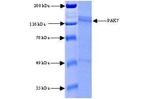 Image no. 1 for P21 Protein (Cdc42/Rac)-Activated Kinase 7 (PAK7) (Active) protein (ABIN411934)