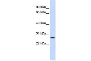 Image no. 1 for anti-LSM12 Homolog B (LSM12B) antibody (ABIN2459597)