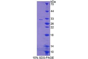 Image no. 1 for CAMP Responsive Element Binding Protein 5 (CREB5) (AA 308-508) protein (T7 tag,His tag) (ABIN6239535)