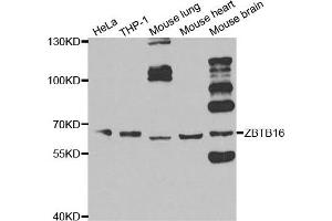 Image no. 1 for anti-Zinc Finger and BTB Domain Containing 16 (ZBTB16) antibody (ABIN2560811)