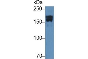 Image no. 3 for alpha-2-Macroglobulin (A2M) ELISA Kit (ABIN6574246)