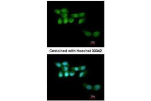 ICC/IF Image Immunofluorescence analysis of paraformaldehyde-fixed A431, using UVSSA antibody [N1N2], N-term , at 1:200 dilution.