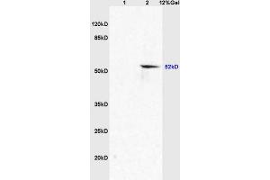 Image no. 2 for anti-Solute Carrier Family 2 (Facilitated Glucose Transporter) Member 8 (SLC2A8) (AA 401-477) antibody (ABIN705746)