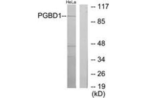 Image no. 1 for anti-PiggyBac Transposable Element Derived 1 (PGBD1) (AA 241-290) antibody (ABIN1534069)