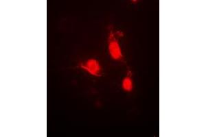 Image no. 3 for anti-Calcium/calmodulin-Dependent Protein Kinase IV (CAMK4) (Center), (pThr200) antibody (KLH) (ABIN2972825)