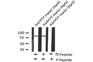 Image no. 4 for anti-Inhibitor of kappa Light Polypeptide Gene Enhancer in B-Cells, Kinase epsilon (IKBKE) (pSer172) antibody (ABIN6271478)