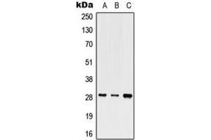 Image no. 1 for anti-Short Stature Homeobox (SHOX) (Center) antibody (ABIN2707050)