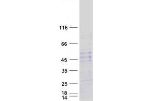 Image no. 1 for Notum Pectinacetylesterase Homolog (NOTUM) protein (Myc-DYKDDDDK Tag) (ABIN2727485)