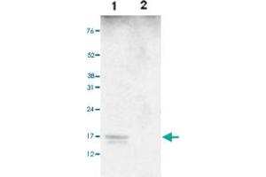 Image no. 6 for anti-Histone Cluster 1, H3a (HIST1H3A) (3meLys27), (pSer28) antibody (ABIN5773863)
