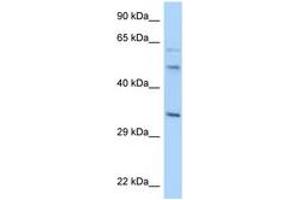 Image no. 1 for anti-Williams Beuren Syndrome Chromosome Region 22 (WBSCR22) (AA 200-249) antibody (ABIN6748061)