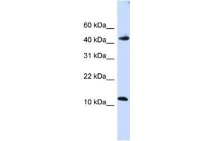 Image no. 1 for anti-Apolipoprotein B mRNA Editing Enzyme, Catalytic Polypeptide-Like 3F (APOBEC3F) (C-Term) antibody (ABIN2776643)