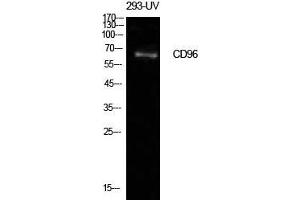 Image no. 2 for anti-CD96 (CD96) (Internal Region) antibody (ABIN3181440)