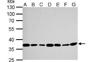 Image no. 4 for anti-Thymidylate Synthetase (TYMS) (Center) antibody (ABIN2855587)