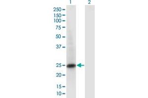 Western Blot analysis of RAB6B expression in transfected 293T cell line by RAB6B monoclonal antibody (M02), clone 1A5.