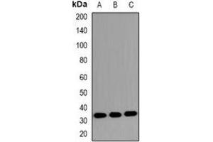 anti-MKI67 FHA Domain-Interacting Nucleolar Phosphoprotein (MKI67IP) (pSer234) antibody