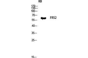 Image no. 3 for anti-Fibroblast Growth Factor Receptor Substrate 2 (FRS2) (Tyr580) antibody (ABIN3184696)