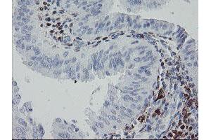 Image no. 4 for anti-Coagulation Factor XIII, A1 Polypeptide (F13A1) antibody (ABIN1498146)