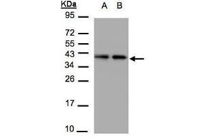 Image no. 3 for anti-Tubulin Folding Cofactor C (TBCC) (Center) antibody (ABIN2856228)