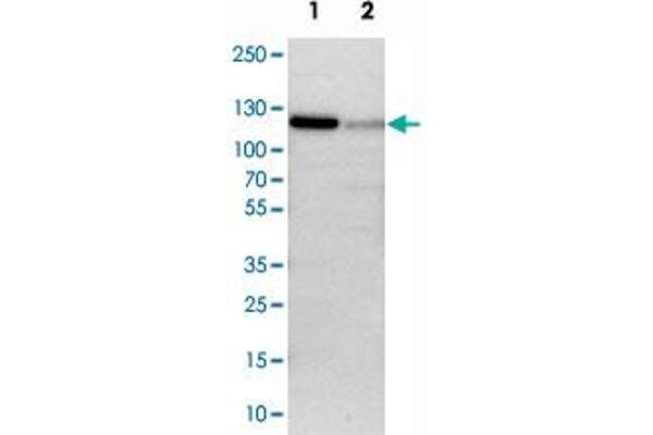 anti-Poly(A) Polymerase alpha (PAPOLA) antibody