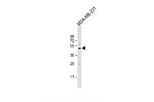 Image no. 4 for anti-Matrix Metallopeptidase 13 (Collagenase 3) (MMP13) (AA 295-324), (C-Term) antibody (ABIN390137)