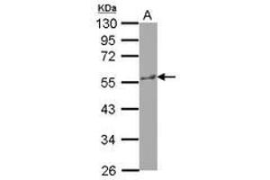 Image no. 1 for anti-Katanin P60 (ATPase Containing) Subunit A 1 (KATNA1) (AA 1-182) antibody (ABIN1498983)