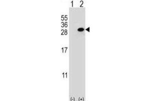 Image no. 1 for anti-Clathrin, Light Chain A (CLTA) antibody (ABIN3004002)