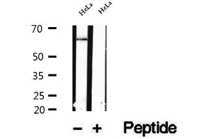 Image no. 1 for anti-Nuclear Factor of kappa Light Polypeptide Gene Enhancer in B-Cells Inhibitor, zeta (NFKBIZ) (Internal Region) antibody (ABIN6263630)