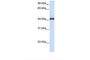 Image no. 1 for anti-Fc Receptor-Like A (FCRLA) (C-Term) antibody (ABIN6738670)
