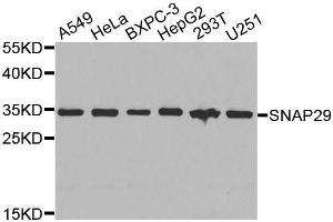 Image no. 2 for anti-Synaptosomal-Associated Protein, 29kDa (SNAP29) antibody (ABIN1682838)