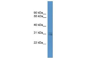Image no. 1 for anti-Synaptosomal-Associated Protein, 29kDa (SNAP29) (Middle Region) antibody (ABIN2788105)