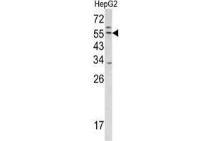 Image no. 1 for anti-Transmembrane Protease, serine 2 (TMPRSS2) (Middle Region) antibody (ABIN453423)