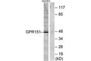 Image no. 1 for anti-G Protein-Coupled Receptor 151 (GPR151) (AA 276-325) antibody (ABIN1535630)