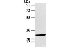 Western blot analysis of Human fetal brian tissue using CALB2 Polyclonal Antibody at dilution of 1:400