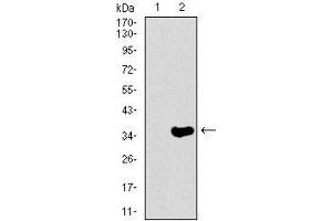 Image no. 4 for anti-Neurofilament, Heavy Polypeptide (NEFH) (AA 968-1020) antibody (ABIN1098127)