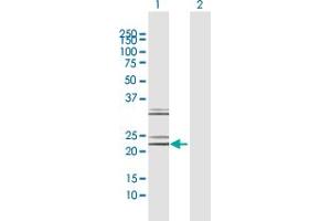 Image no. 1 for anti-Neurotrophin 4 (NTF4) (AA 1-210) antibody (ABIN518446)