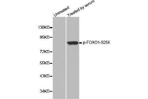 Image no. 1 for anti-Forkhead Box O1 (FOXO1) (pSer256) antibody (ABIN3019710)