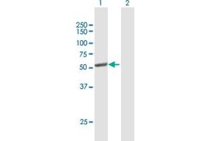 Western Blot analysis of CYP2C8 expression in transfected 293T cell line by CYP2C8 MaxPab polyclonal antibody.