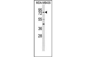 Image no. 1 for anti-Regulatory Factor X 3 (RFX3) (AA 660-690), (C-Term) antibody (ABIN954526)