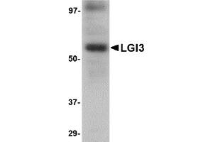 Western Blotting (WB) image for anti-Leucine-Rich Repeat LGI Family, Member 3 (LGI3) (Middle Region) antibody (ABIN1030983)