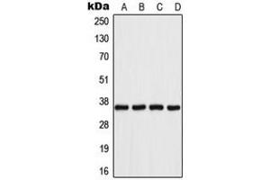 Image no. 3 for anti-Aldo-Keto Reductase Family 1, Member B1 (Aldose Reductase) (AKR1B1) (C-Term) antibody (ABIN2704469)
